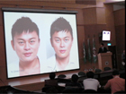Sculptra 3D聚左旋乳酸 舒顏萃 塑然雅 台灣發表會